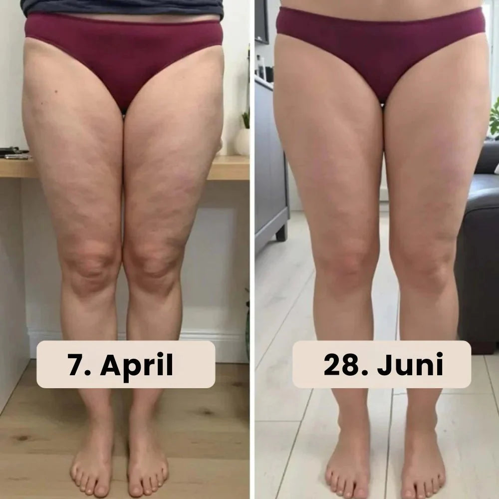 Seamless Anti Cellulite Leggings